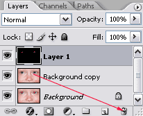 Remove Layer
