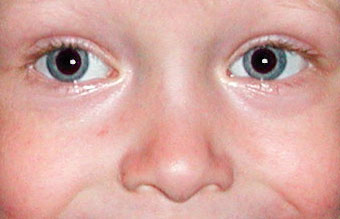 Red Eyes corrected with separate layer